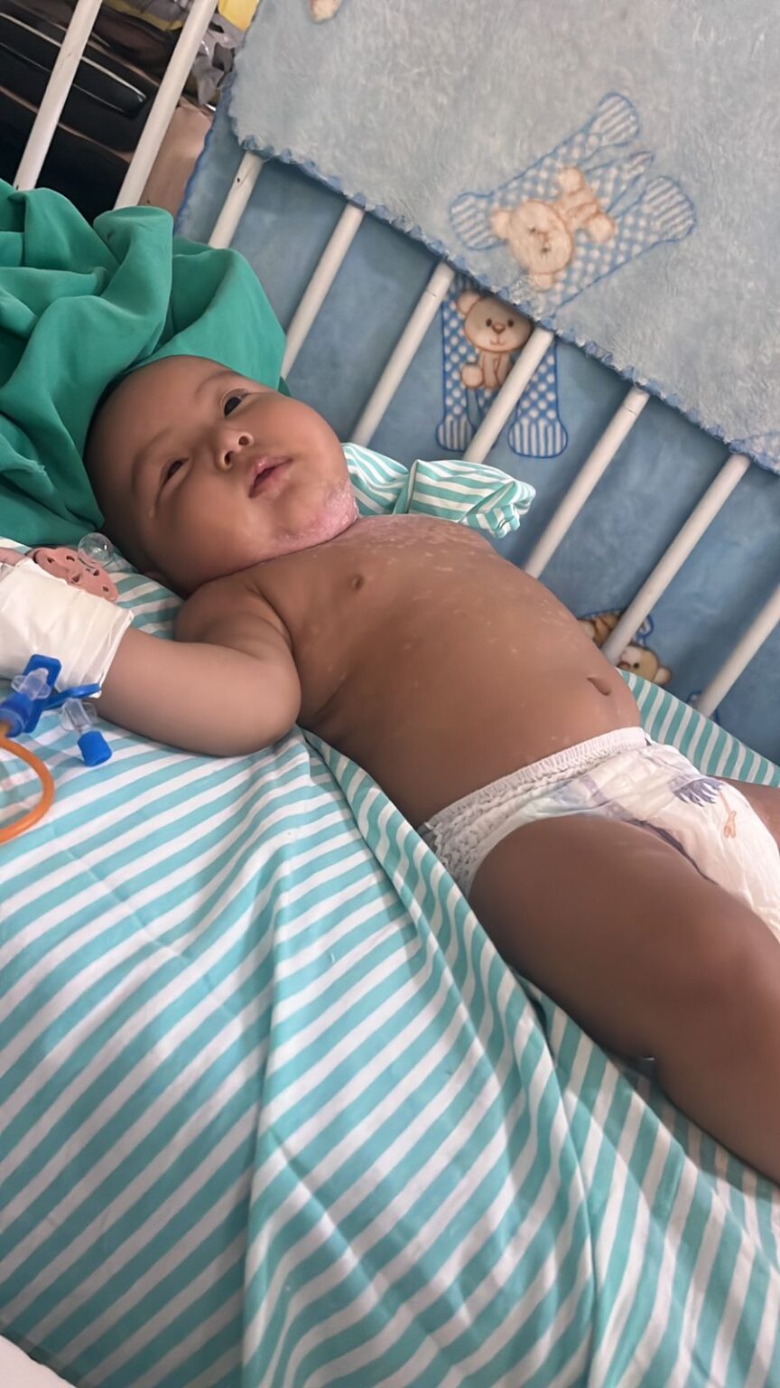 Bebê de 7 Meses Evolui Bem em Tratamento Após Denúncia de Maus-Tratos Bebê de 7 Meses Evolui Bem em Tratamento Após Denúncia de Maus-Tratos