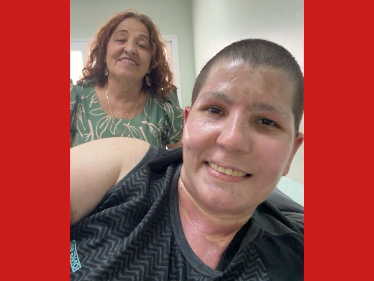 Mulher Que Sofreu Queimaduras Extensas Recebe Alta Após 30 Dias: 'Uma Felicidade'