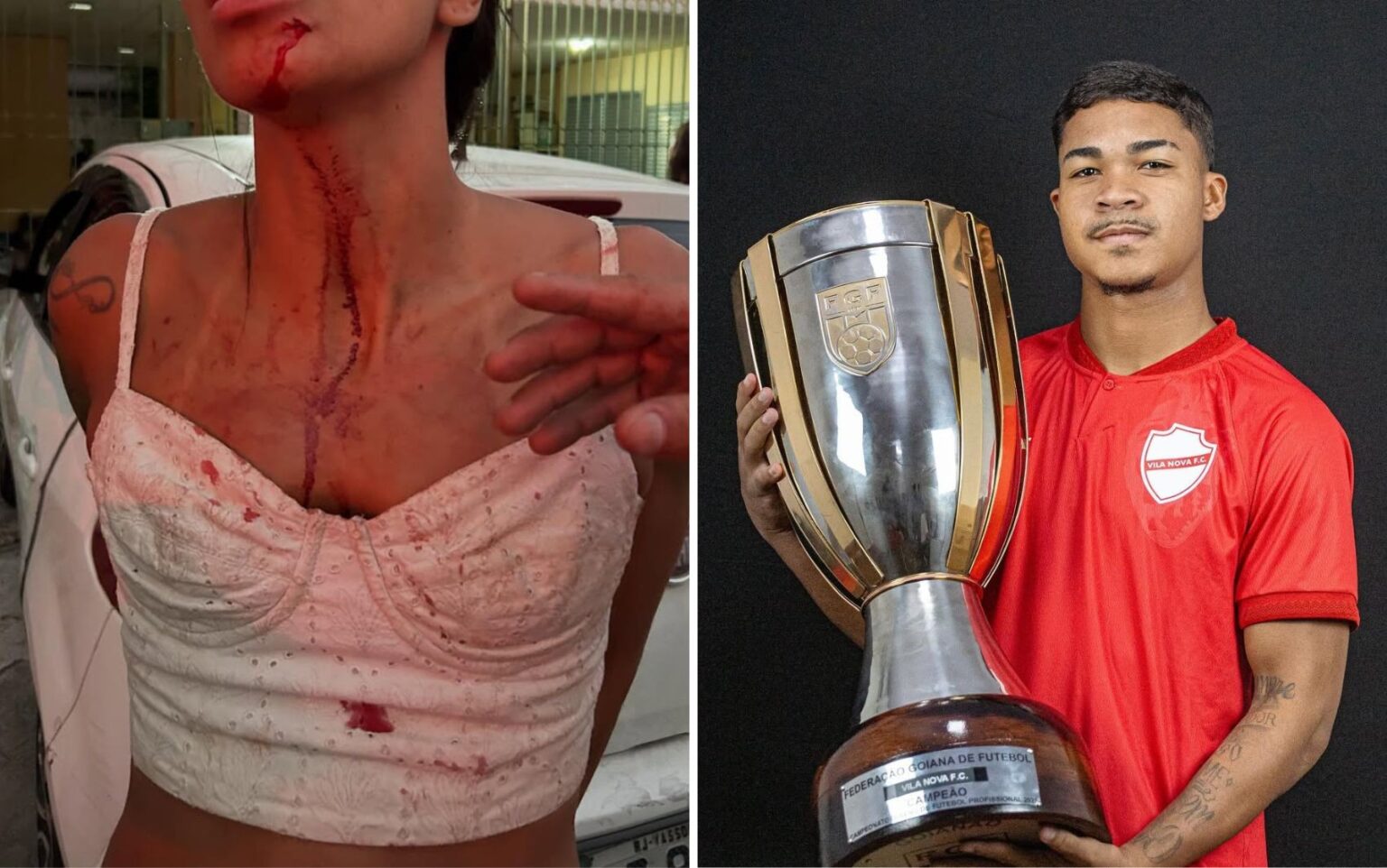 Mulher denuncia agressão por jogador do Vila Nova e revela apoio do marido