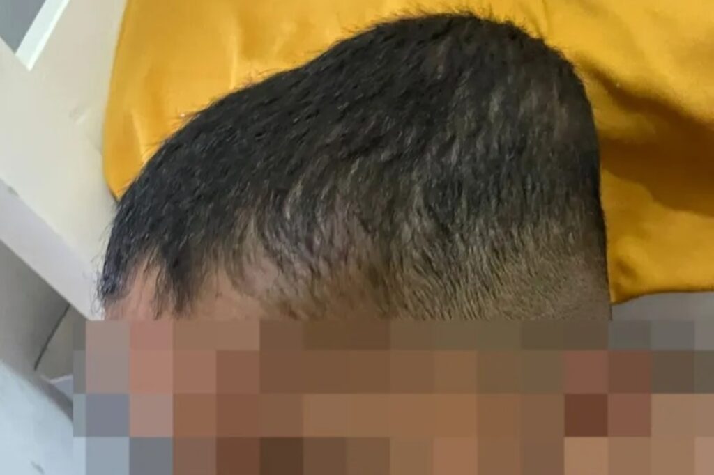 Babá de Criança Autista em Alagoas Denunciada por Agressões