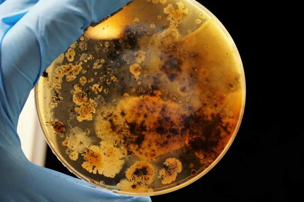 Resistência Bacteriana: Um Desafio de Saúde Pública no Brasil