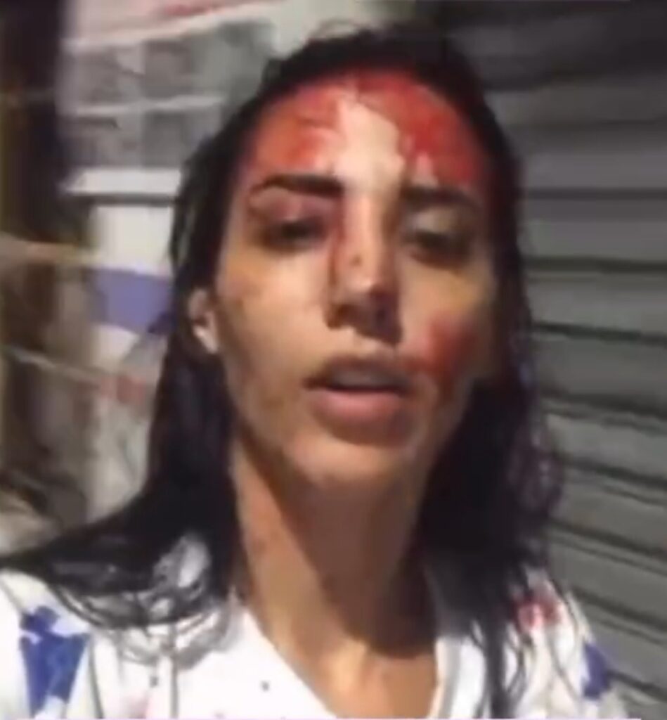 Jovem de Maceió Responderá em Liberdade por Tentativa de Homicídio Após Agressão Doméstica