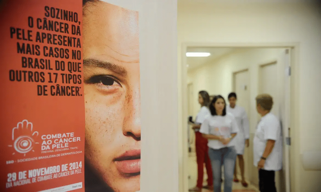 Câncer de Pele: Casos Crescem Dramaticamente no Brasil em 10 Anos