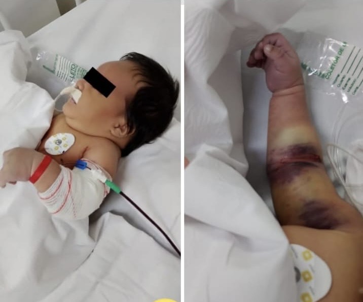 Urgência do Protocolo Benício Xavier em Debate Após Caso de Bebê com Condições Especiais Urgência do Protocolo Benício Xavier em Debate Após Caso de Bebê com Condições Especiais