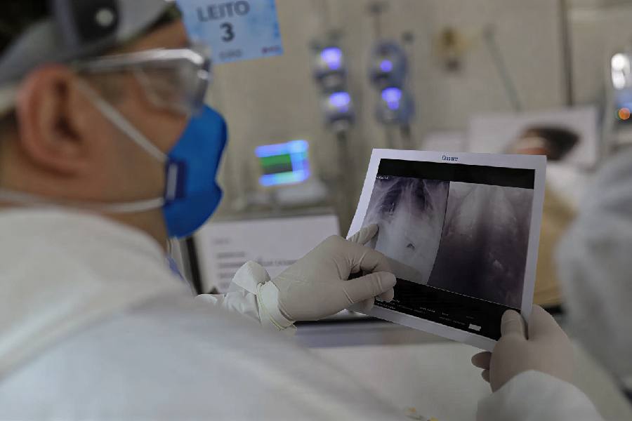 Infecções Respiratórias em Alta no Brasil: Alerta para Hospitais e Autoridades Infecções Respiratórias em Alta no Brasil: Alerta para Hospitais e Autoridades