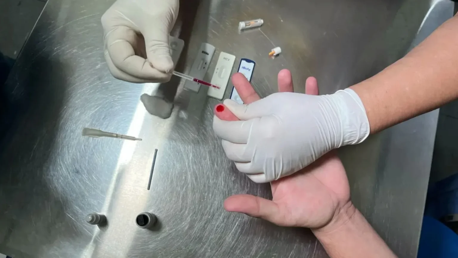 Governo do Amapá destaca testagem e tratamento para controlar a sífilis