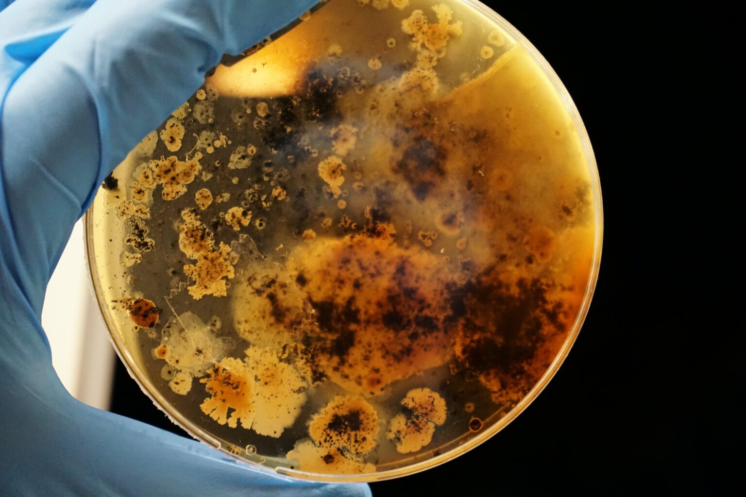 Resistência Bacteriana: Um Desafio Crítico à Saúde Pública no Brasil