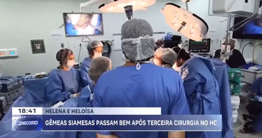Gêmeas Siamesas Realizam Terceira Cirurgia de Separação em Ribeirão Preto (SP)