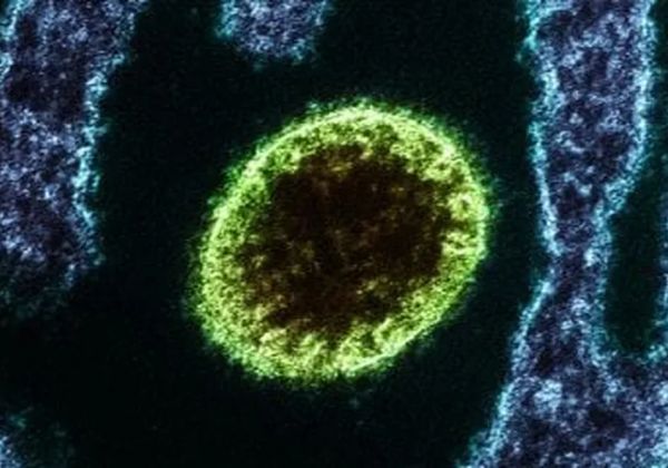 Ministério da Saúde Alerta: Novo Vírus Nipah e Risco de Contaminação no Brasil