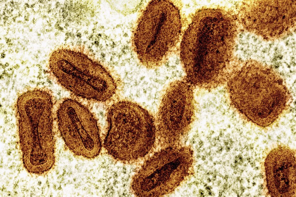 Bahia: Informação Falsa sobre 38 Casos de Mpox no Carnaval