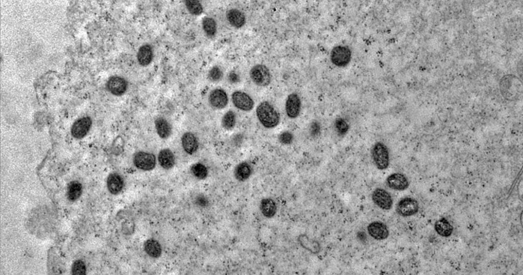 Mpox: Brasil Registra 140 Casos, Mas Ministério da Saúde Não Vê Motivo para Alerta