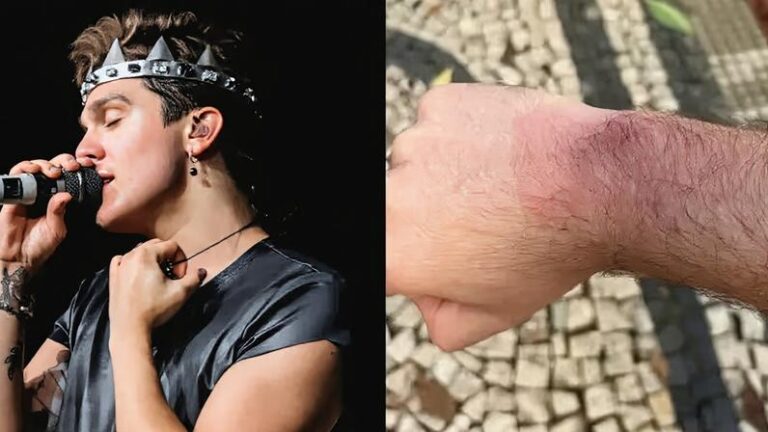 Fãs de Luan Santana Relatam Queimaduras Após Uso de Pulseiras de LED em Show