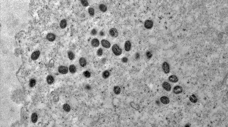 Minas Gerais Registra Sete Casos de Mpox; Belo Horizonte É a Mais Afetada
