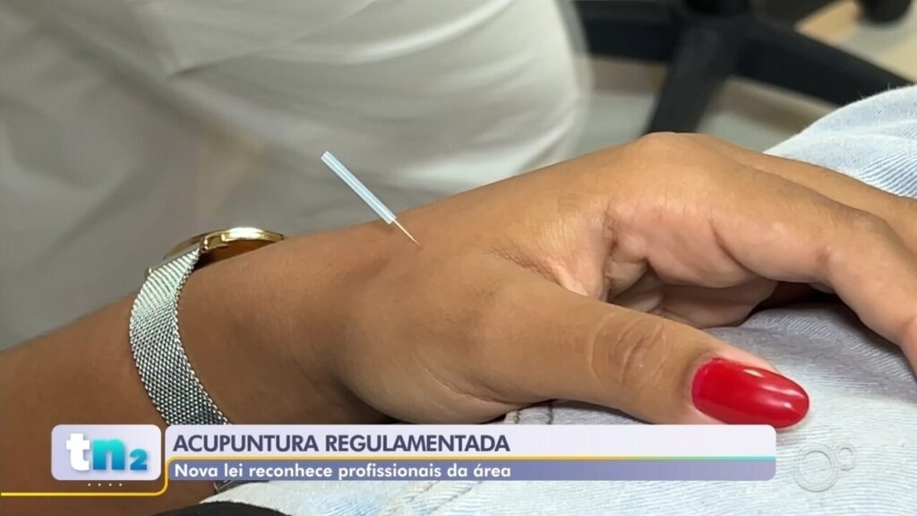 Acupuntura e Ciência: Pesquisas Evidenciam os Benefícios da Técnica