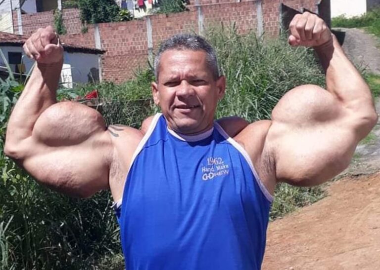 Morte de Arlindo Anomalia, o ‘Popeye Brasileiro’, aos 55 anos choca comunidade Morte de Arlindo Anomalia, o 'Popeye Brasileiro', aos 55 anos choca comunidade