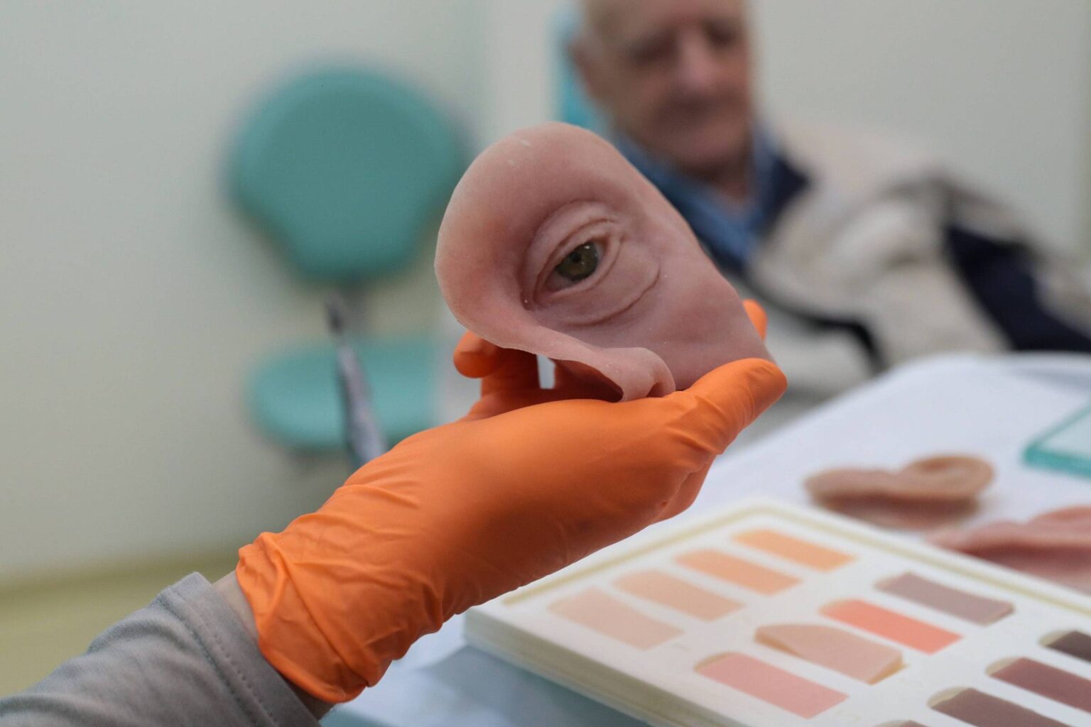 Prótese Facial pelo SUS no Paraná: Tecnologia que Restaura a Autoestima