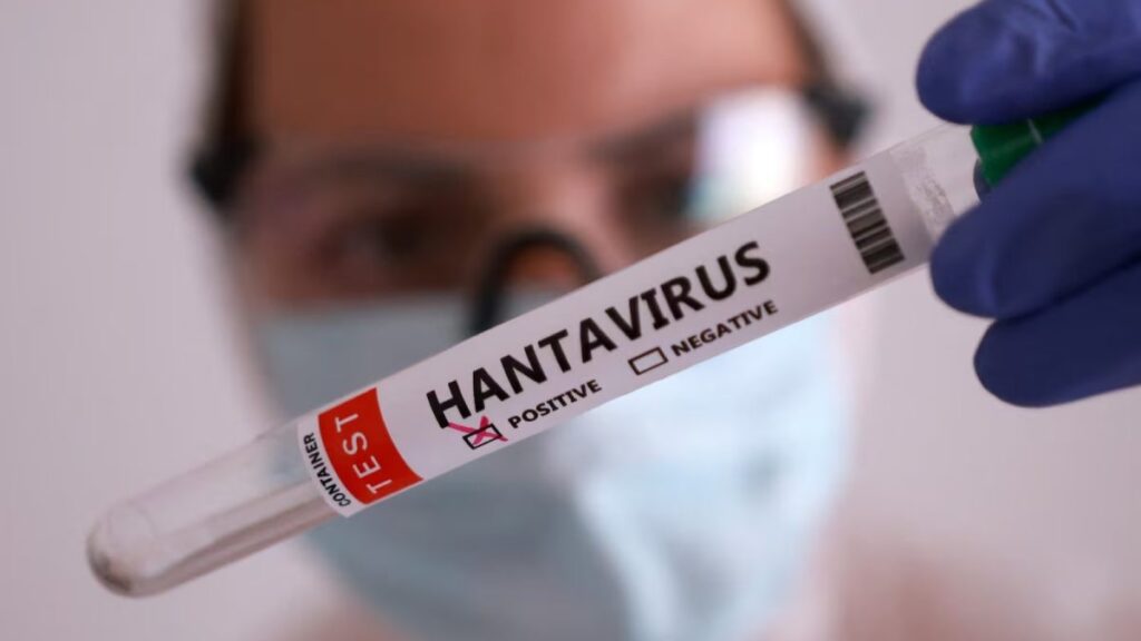 Hantavírus em Santa Catarina: Situação Controlada e Sem Transmissão Entre Pessoas Hantavírus em Santa Catarina: Situação Controlada e Sem Transmissão Entre Pessoas