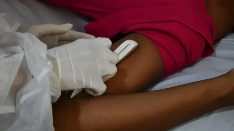 Alagoinhas amplia acesso ao implante Implanon para fortalecer planejamento familiar