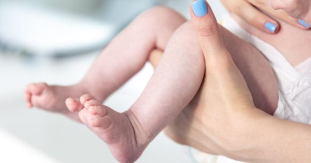Tragédia em SC: Bebê de 6 Meses Perde a Vida por Meningite Bacteriana Tragédia em SC: Bebê de 6 Meses Perde a Vida por Meningite Bacteriana