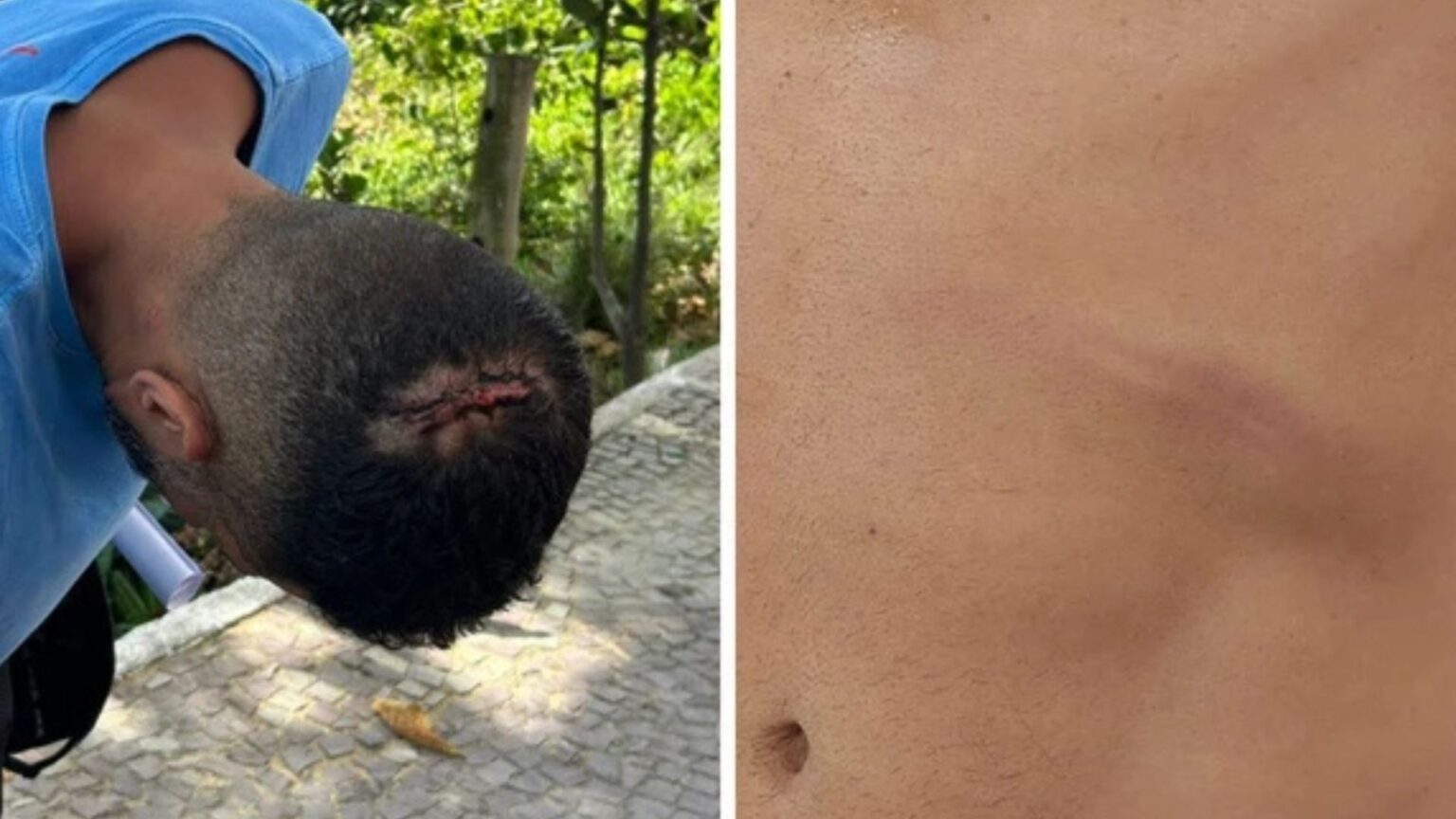 Turista Mineiro Agredido em Quiosque de Vila Velha Após Questionar Conta Turista Mineiro Agredido em Quiosque de Vila Velha Após Questionar Conta