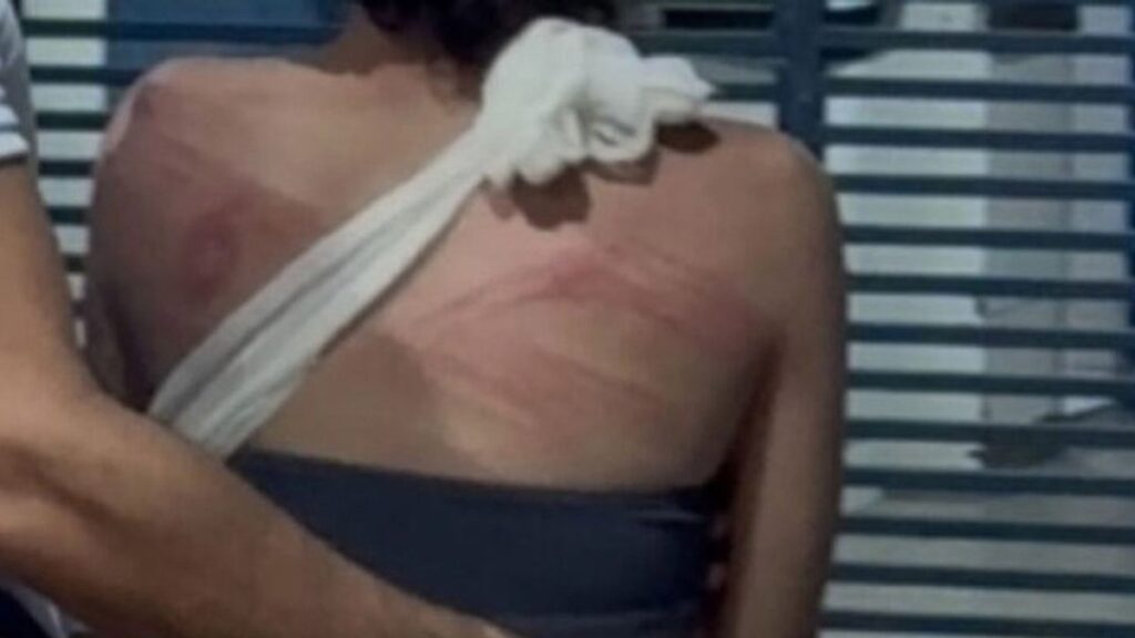 Adolescente Brutalmente Agredida em Cemitério de Imperatriz: Entenda os Detalhes Imagem do artigo