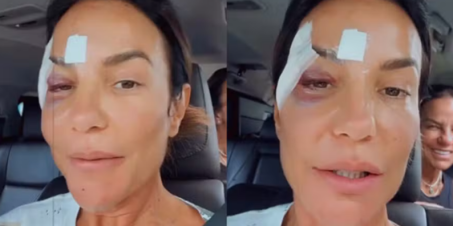 Ivete Sangalo Recebe Alta Após Desmaio e Fala Sobre Sua Recuperação Ivete Sangalo Recebe Alta Após Desmaio e Fala Sobre Sua Recuperação