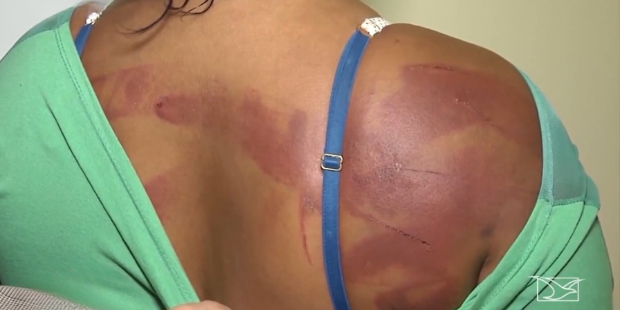 Imperatriz Registra Quase 4 Denúncias Diárias de Violência Contra a Mulher Imperatriz Registra Quase 4 Denúncias Diárias de Violência Contra a Mulher