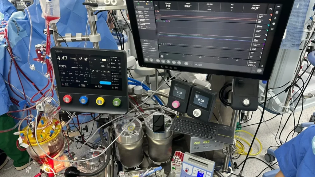 Hospital Central de Mato Grosso implanta tecnologia inédita para cirurgias cardíacas pelo SUS