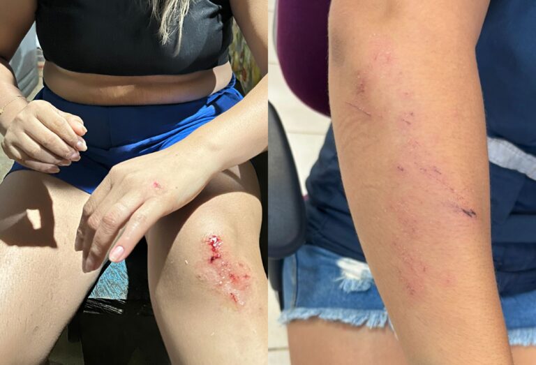 Agressão à Técnica de Enfermagem em Polo de Saúde Yanomami Levanta Preocupações Agressão à Técnica de Enfermagem em Polo de Saúde Yanomami Levanta Preocupações
