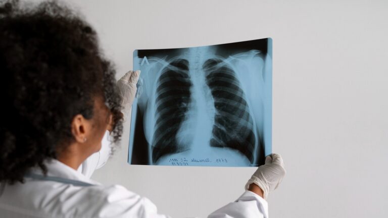Instituto Nacional de Câncer Lança Estudo Para Rastrear Câncer de Pulmão no SUS Instituto Nacional de Câncer Lança Estudo Para Rastrear Câncer de Pulmão no SUS