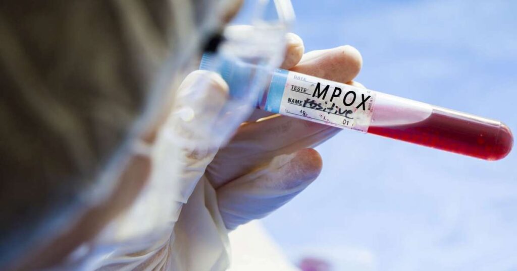 Mpox: OMS reporta mais de 100 mil casos confirmados globalmente