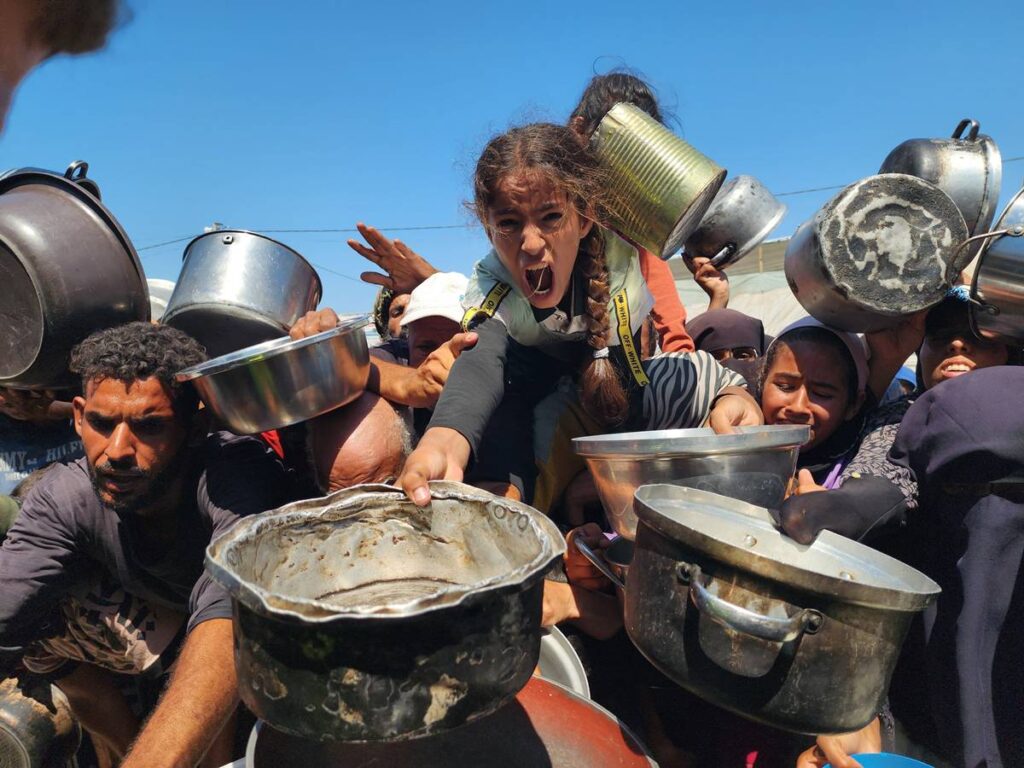 ONU Revela: 20% das Crianças em Gaza Sofrem de Desnutrição Imagem do artigo