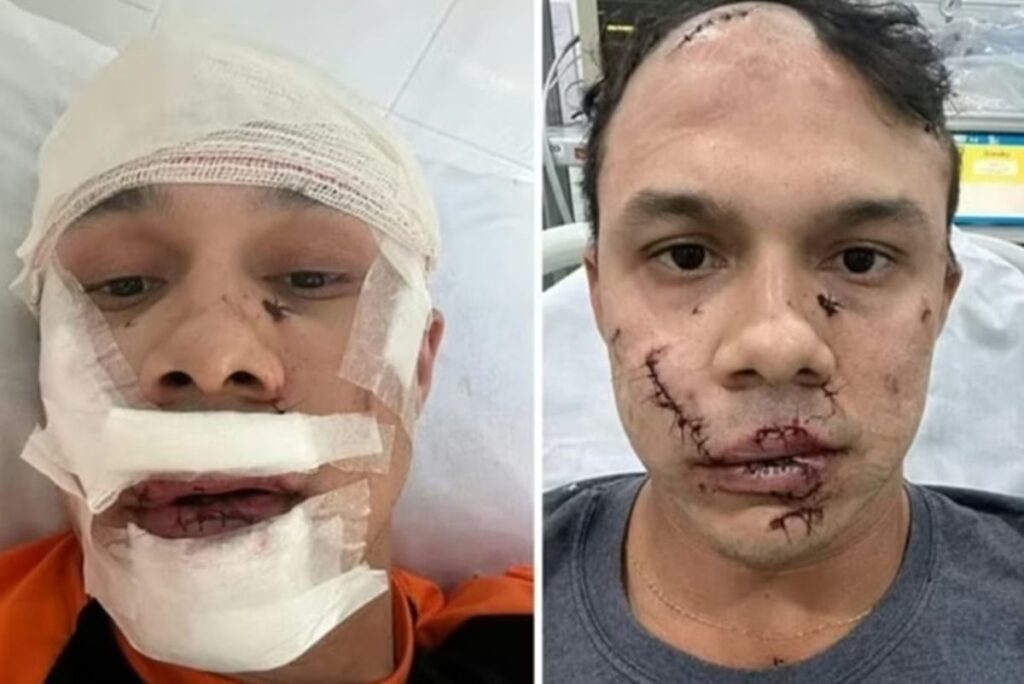 Briga em Bar: Suspeito Confessa Agressão a Personal Trainer em Águas de Lindóia Imagem do artigo