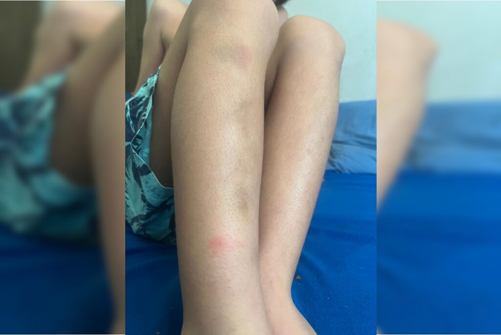 Bizarra abordagem policial deixa filho de publicitário com hematomas Imagem do artigo