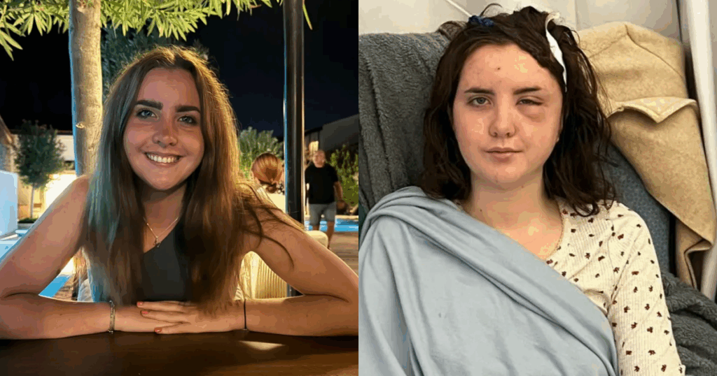 Jovem Descobre Tumor Cerebral Após Pensar Que Tinha Insolação: Entenda o Caso de Moli Morgan Imagem do artigo