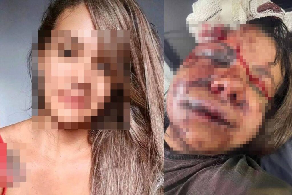 Mulher Violentamente Espancada por Ex-Namorado Passará por Cirurgia Facial Imagem do artigo