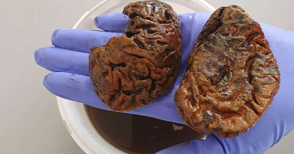 A Cientista que Estuda Cérebros Antigos: O Mistério da Preservação ao Longo de Milênios Imagem do artigo