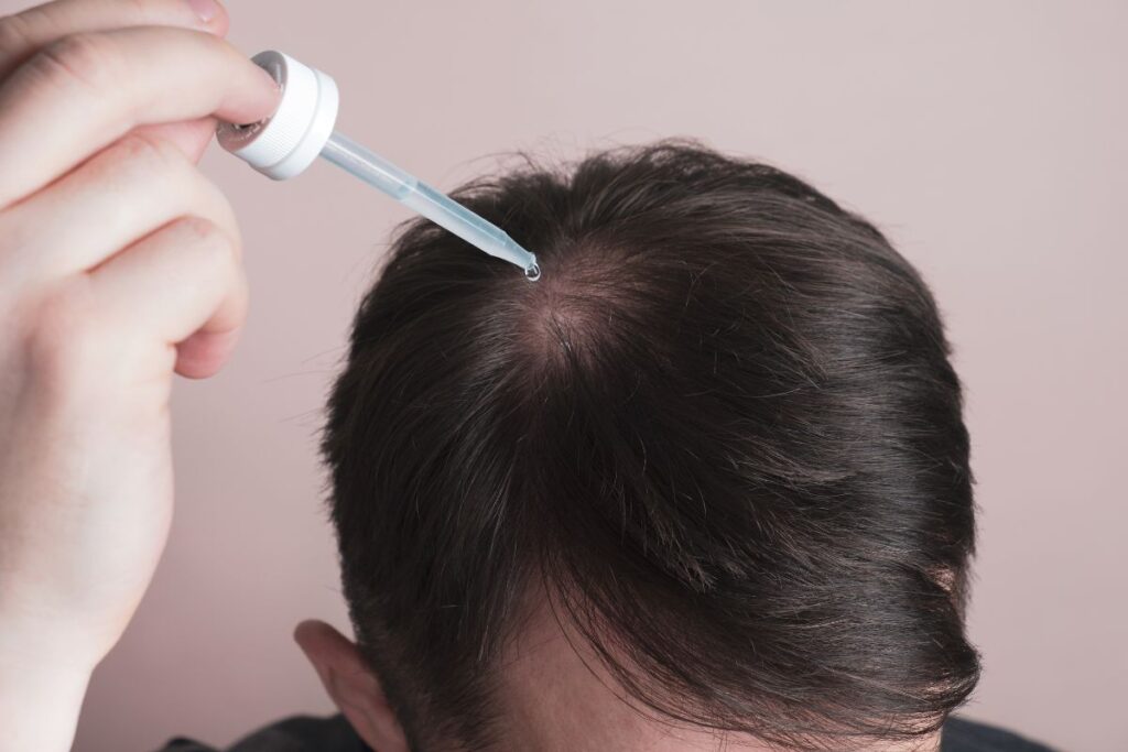 Óleo de Rícino: O Segredo Natural para Hidratação, Crescimento e Combate à Queda do Cabelo Imagem do artigo