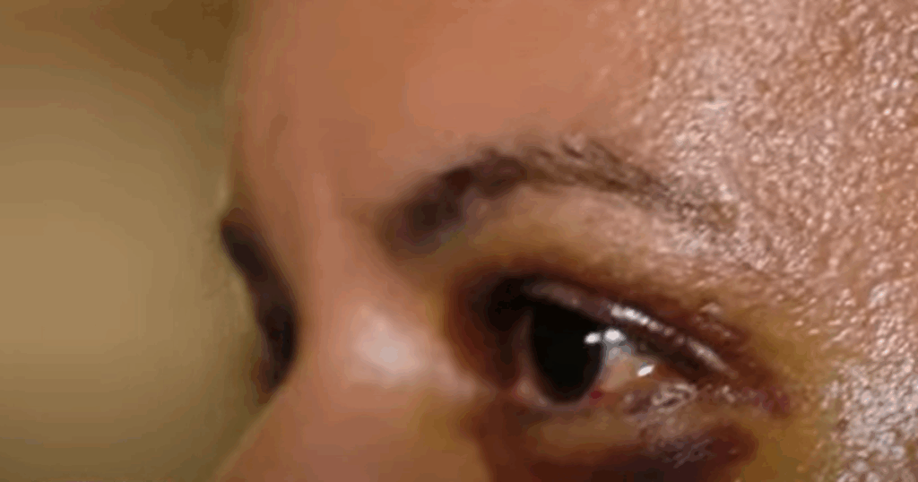 Ex-namorada de ex-jogador revela ter sofrido 61 socos: ‘Ele queria me matar’ Imagem do artigo