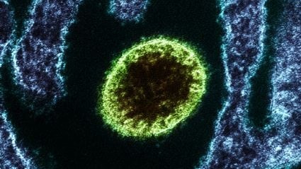 Ministério da Saúde Alerta sobre Vírus Nipah: Risco no Brasil é Baixo Ministério da Saúde Alerta sobre Vírus Nipah: Risco no Brasil é Baixo