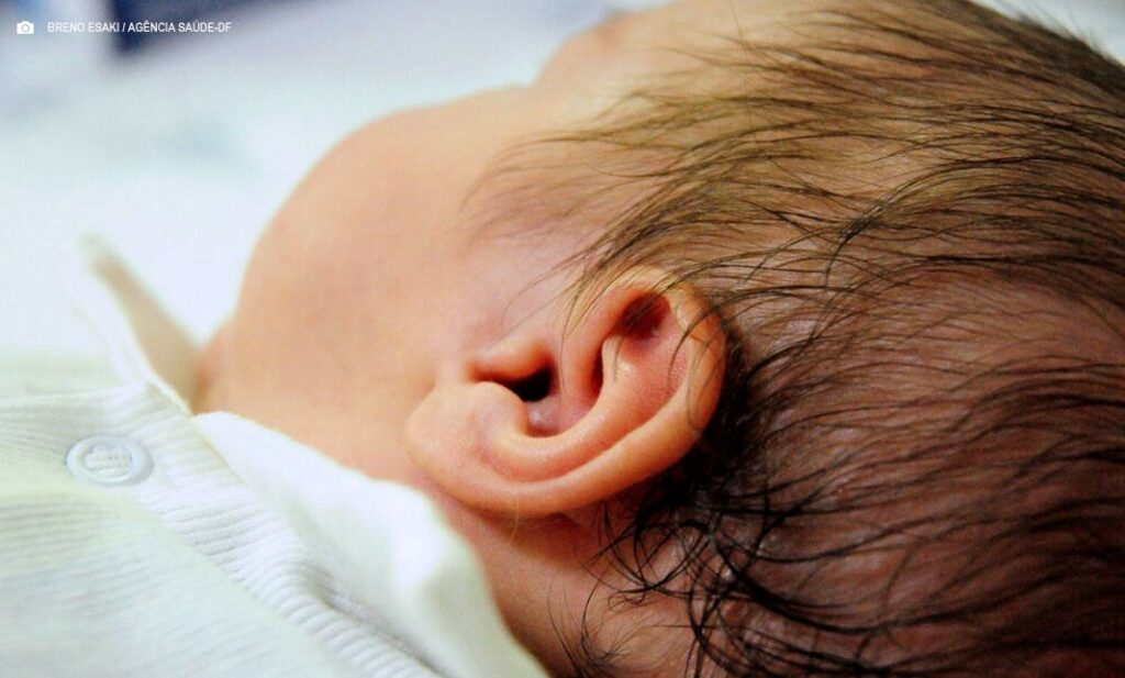 Teste da Orelhinha em Maternidades: A Importância da Triagem Auditiva Neonatal