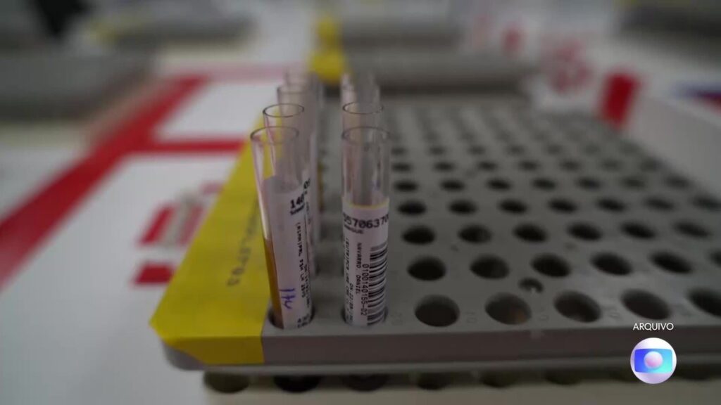Uso da PrEP contra o HIV no DF Aumenta Três Vezes em 2023, Superando Meta Nacional Uso da PrEP contra o HIV no DF Aumenta Três Vezes em 2023, Superando Meta Nacional