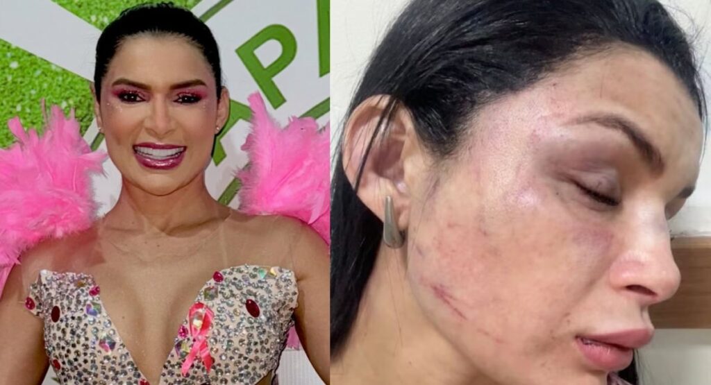Suspeito de Agredir Musa de Escola de Samba em Manaus é Detido por Falso Motorista de Aplicativo Suspeito de Agredir Musa de Escola de Samba em Manaus é Detido por Falso Motorista de Aplicativo