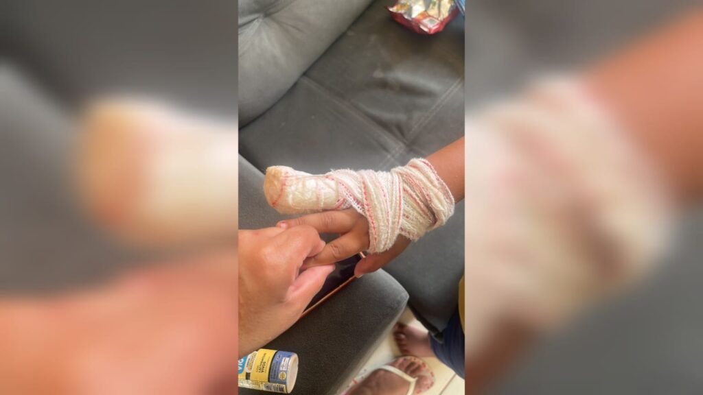Criança de 4 Anos Sofre Amputação Após Acidente em Creche de Sorocaba