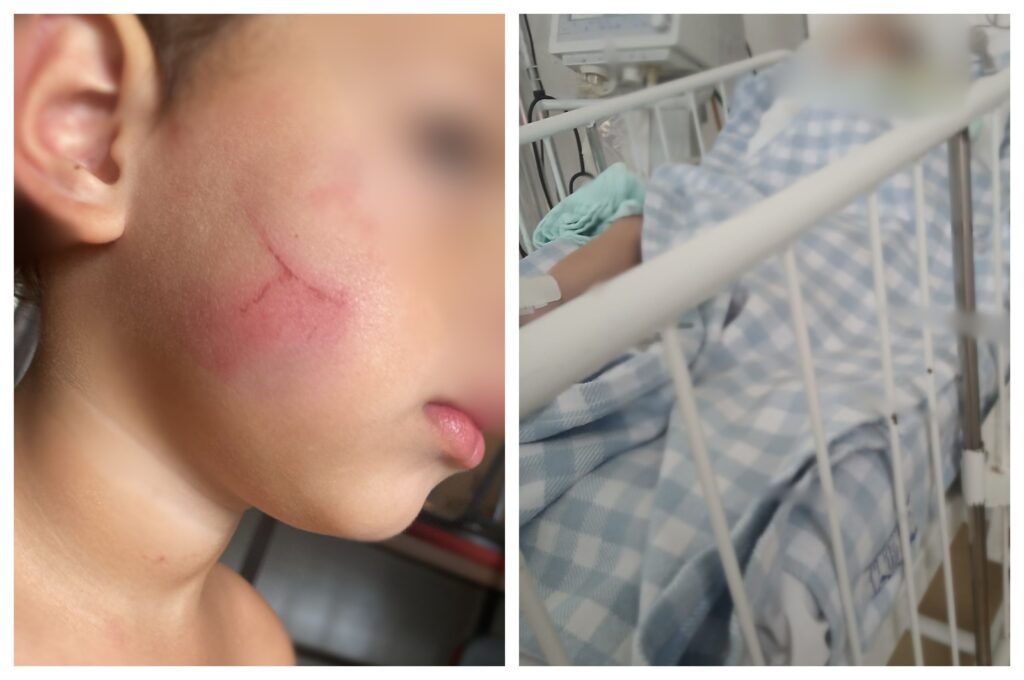 Bebê Internado em UTI: Agressão de Babá Relatada pelo Irmão de 3 Anos