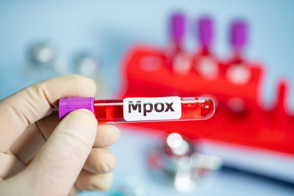 Minas Gerais Registra 7 Casos de Mpox em 2024 - Entenda os Sintomas e Prevenção