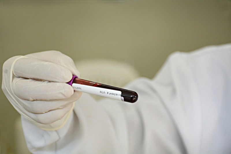 Resultados de Exames de Sangue Agora Disponíveis no MG App para Doador em Minas Gerais Resultados de Exames de Sangue Agora Disponíveis no MG App para Doador em Minas Gerais