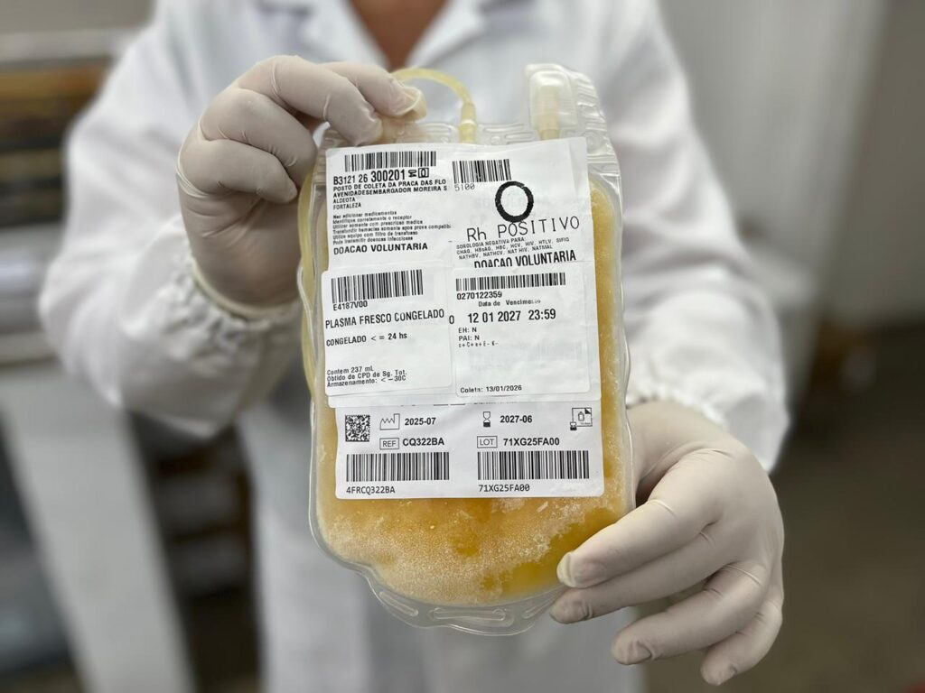Hemoce Alcança 200 Mil Litros de Plasma: Avanços na Saúde Pública do Ceará Hemoce Alcança 200 Mil Litros de Plasma: Avanços na Saúde Pública do Ceará