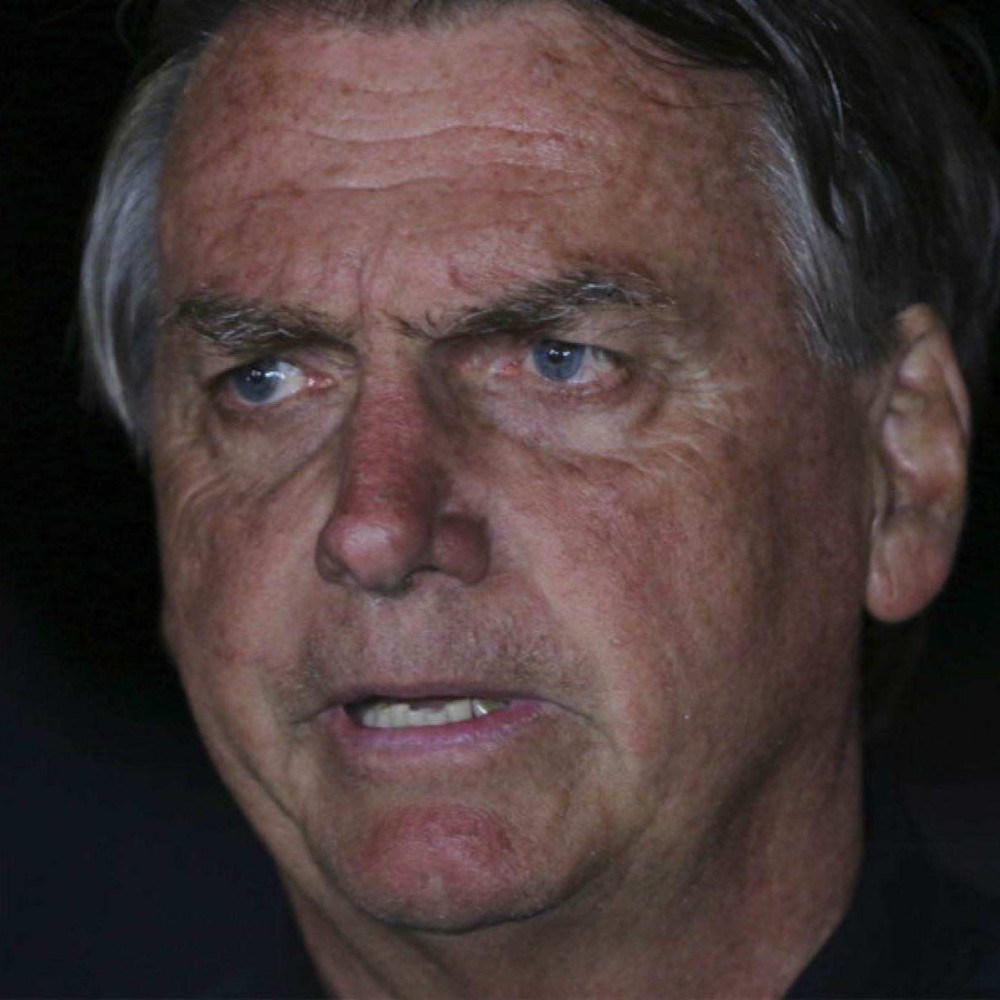 Bolsonaro Realiza Procedimento para Controlar Soluços: Entenda o Caso Bolsonaro Realiza Procedimento para Controlar Soluços: Entenda o Caso
