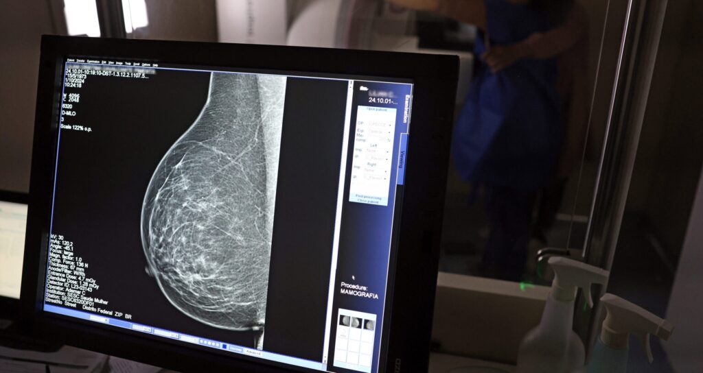 Como a IA Pode Prever Doenças Cardíacas em Mulheres Através de Mamografias Como a IA Pode Prever Doenças Cardíacas em Mulheres Através de Mamografias